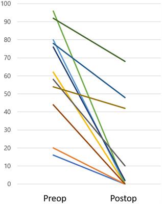 Assessing the efficacy of perilymphatic fistula repair surgery in alleviating vestibular symptoms and associated auditory impairments